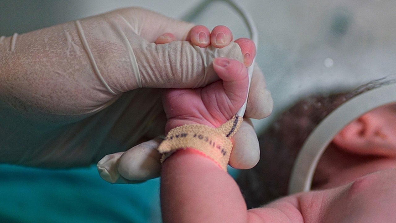Doğar doğmaz ameliyata alındı! Milyonda bir görülen vakayla doğdu!