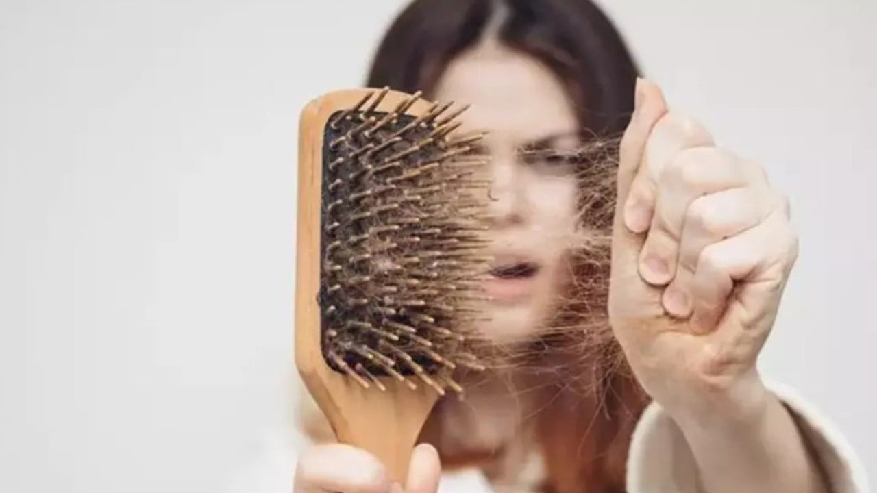 Doktor açıkladı: Saç dökülmesinin nedeni öyle bir şey ki kimsenin aklına gelmez!