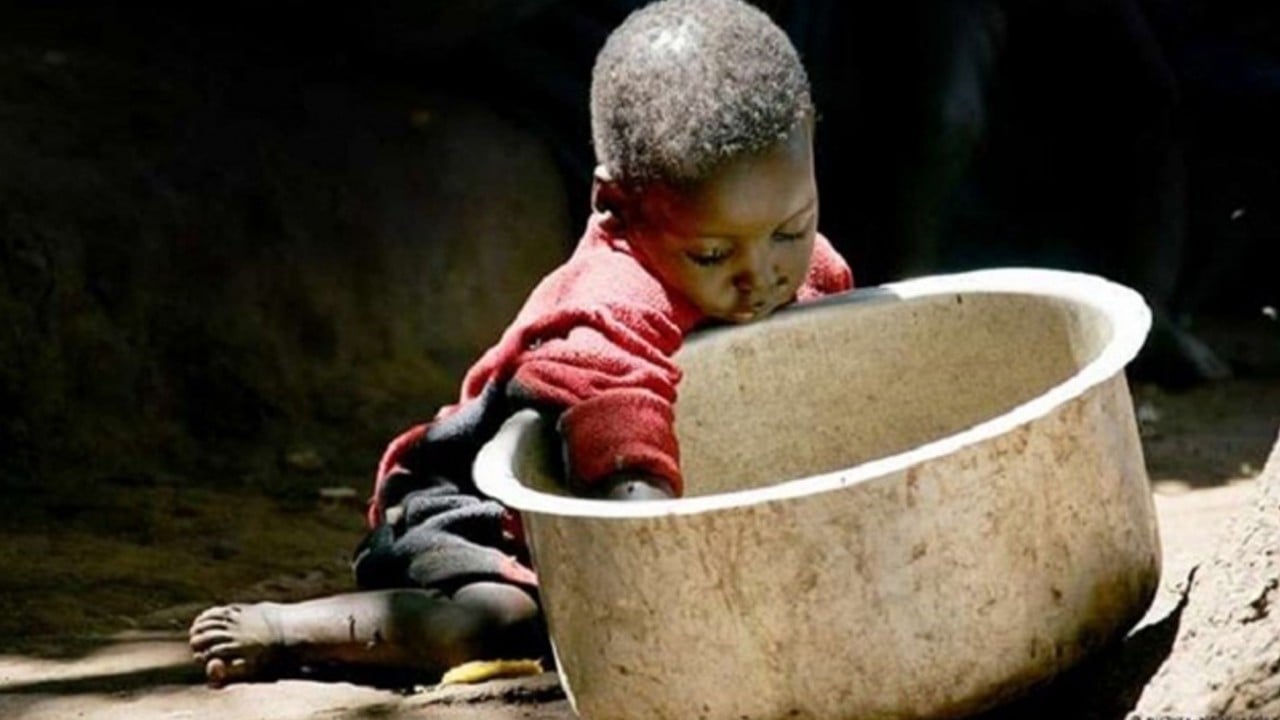 Dünyanın utanç tablosu: 2030 yılı açlık tahmini