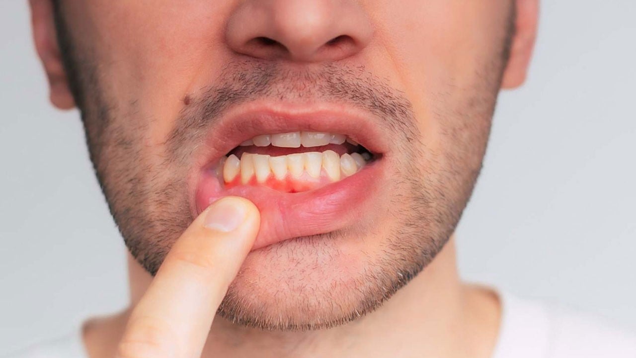 Erken teşhis önemli! Vücuttaki bu sinyalleri hafife almayın