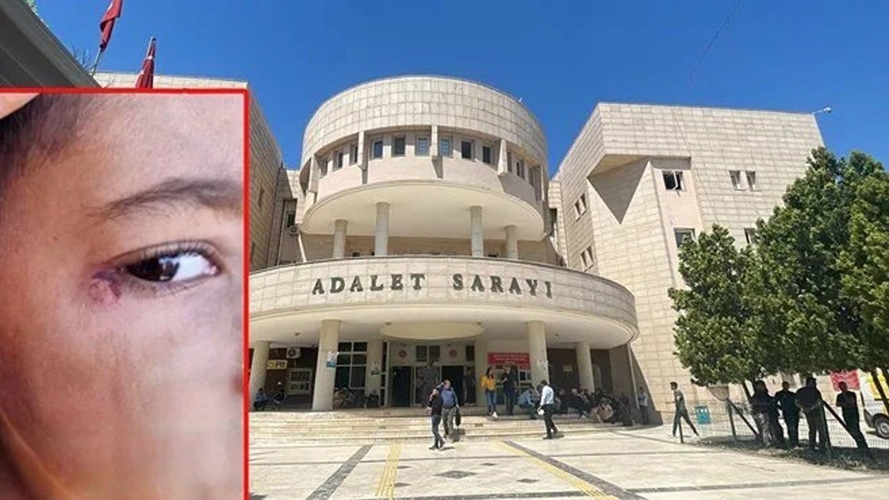 Harran’da öğrenciye sigara işkencesi: Temizlik görevlisi tutuklandı