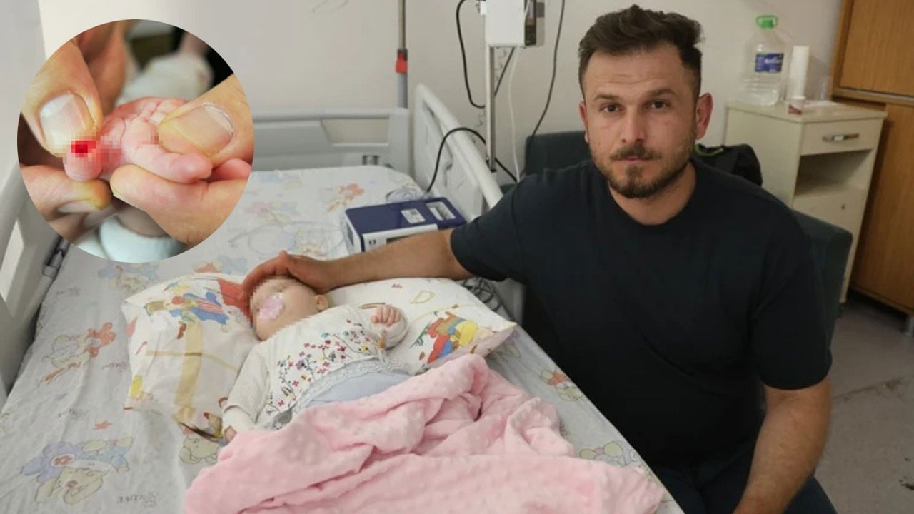 Hemşire sargıyı keserken bebeğin parmağını kesti
