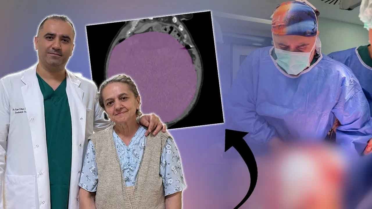 İstanbul'da tıp dünyasını şaşkına çeviren olay! Karnındaki şişliği kabızlık sanan kadından tam 22 kiloluk dev kitle çıkarıldı!