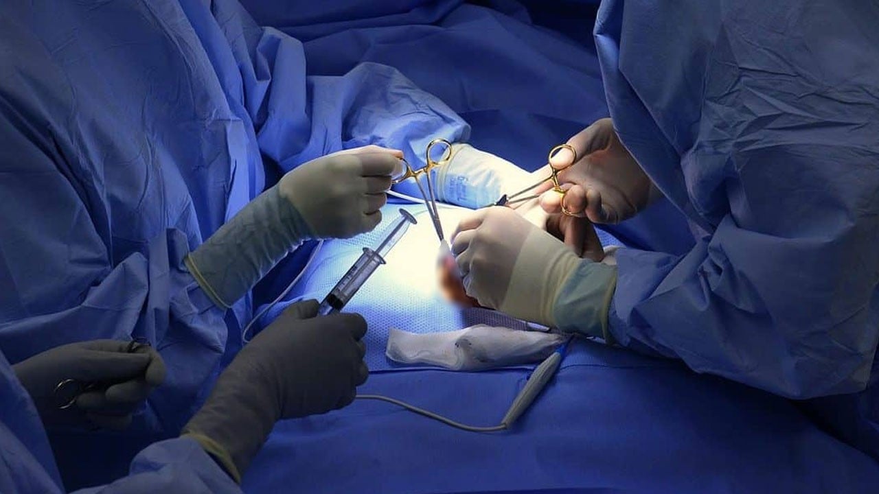 Kabızlık sandı, gerçek ameliyatta ortaya çıktı! Karnından tam 2 litre boşaltıldı