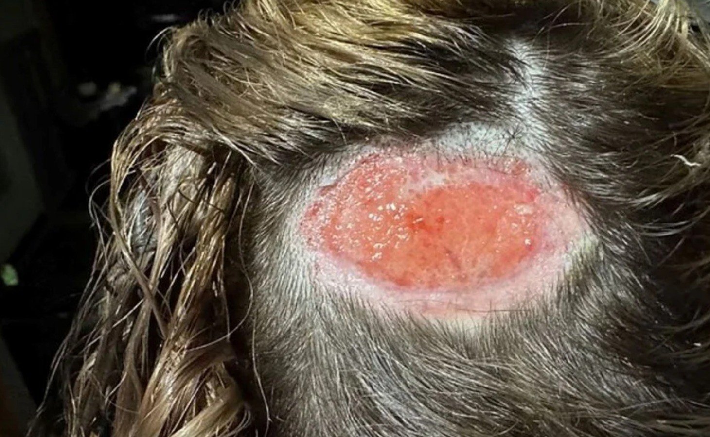 Kafada açılan delikler: Kendinize zehir enjekte etmeyin