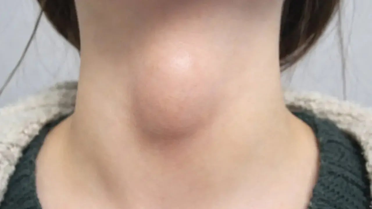 Kulağınızdaki tehlikeye dikkat! Her gün taktığınız o cihaz tiroidi vuruyor!