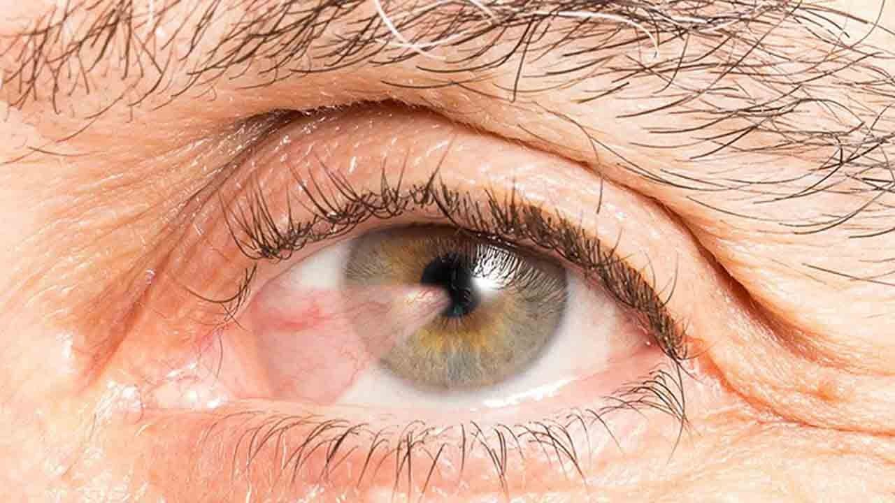 Masum sanılıyor ama görme kaybına yol açabiliyor! Göz etine yol açan 4 önemli etken!