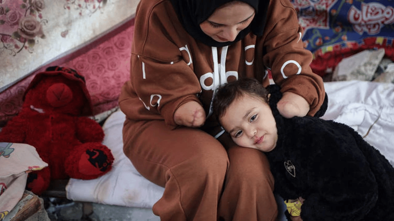 Müslüman anne Yahudilerin saldırısında iki elini kaybetti