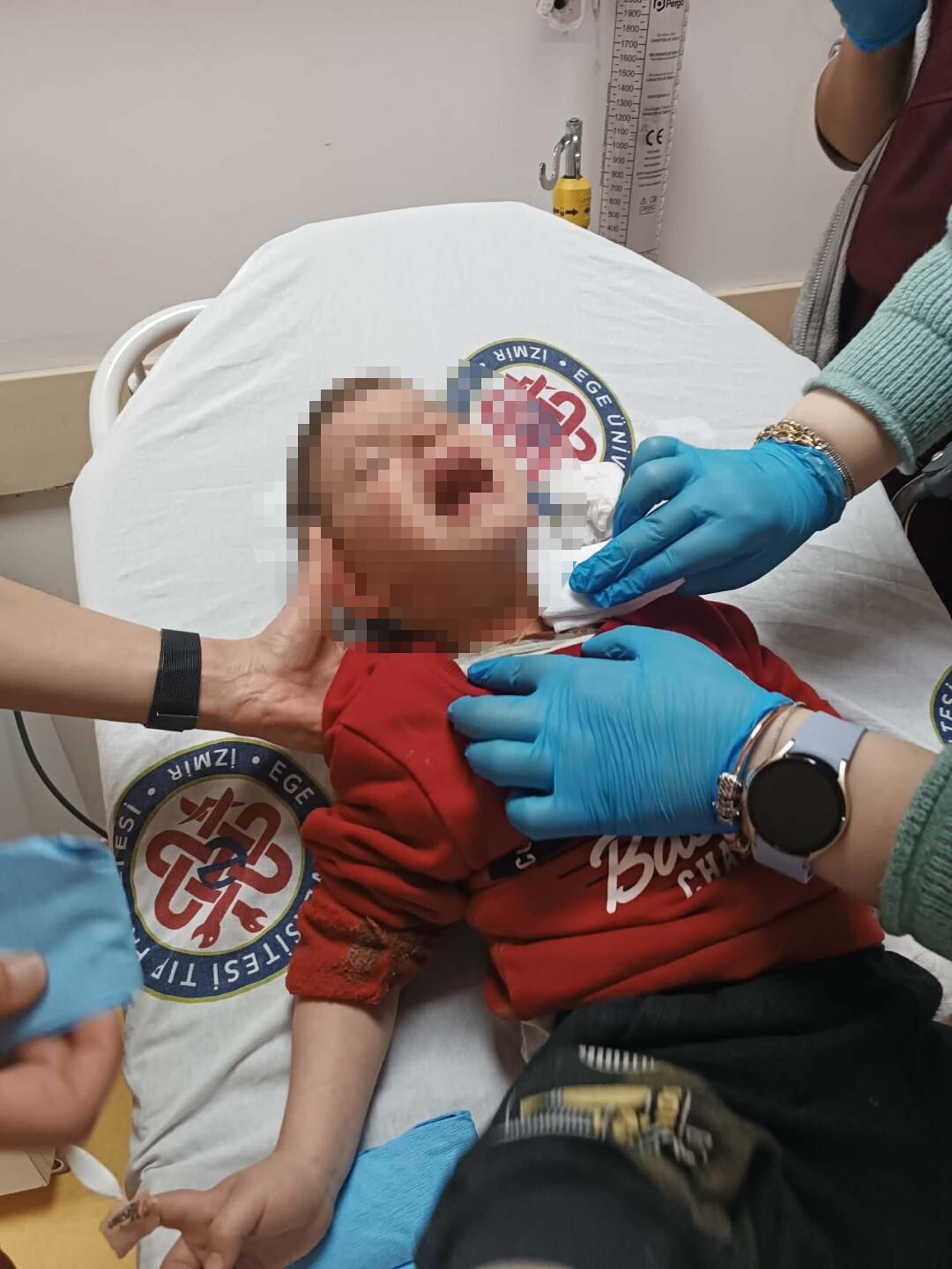 Parkta rastgele bıçak sallayıp, 2 yaşındaki Samet’i boğazından yaralayan şüpheli tutuklandı