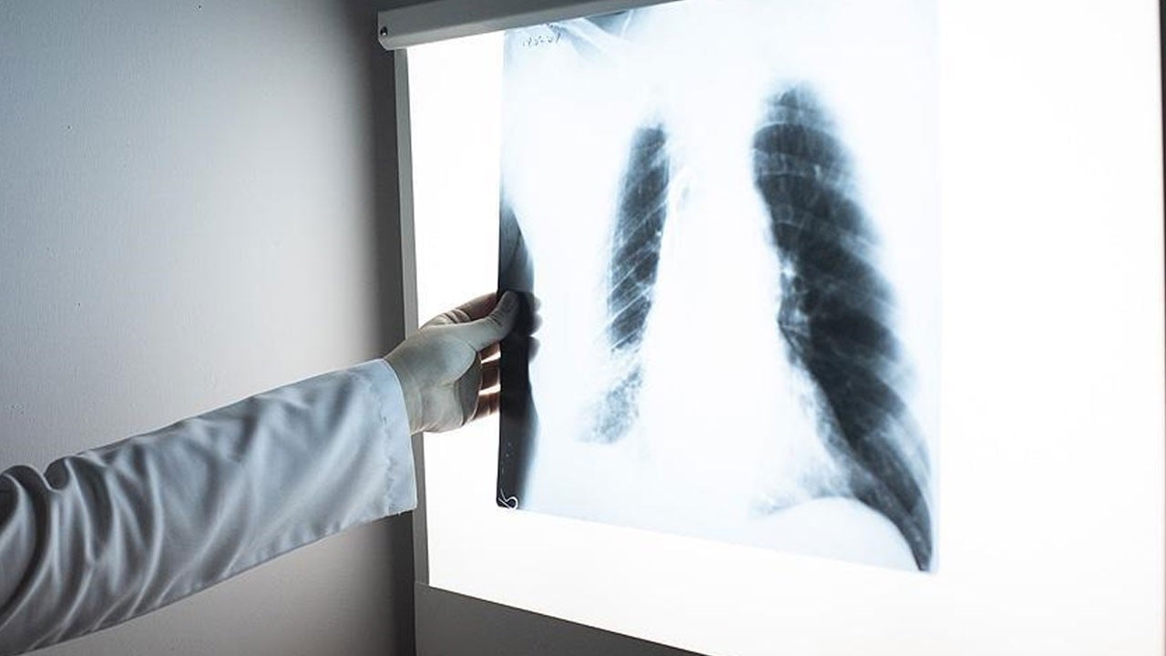 Sessiz tehdit sürüyor! Halen en ölümcül hastalıklardan biri