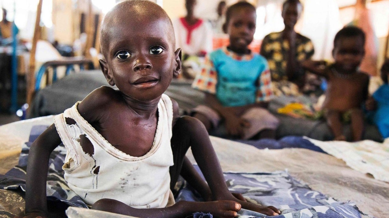Sudan’da çocuklar ölüme terk edildi! UNICEF’ten yürek burkan rapor