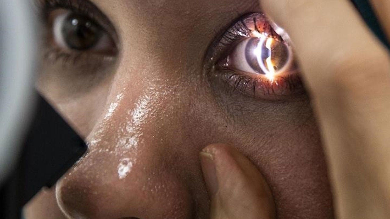 Uzman isimden kritik uyarı! Yapay zekaya danışanlar gözlerini kaybedebilir