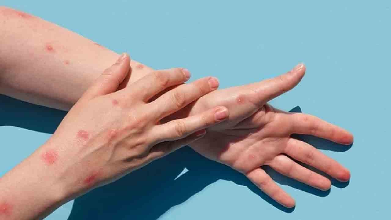 Virüs 16 vilayete yayıldı: Can kaybı 8’e yükseldi