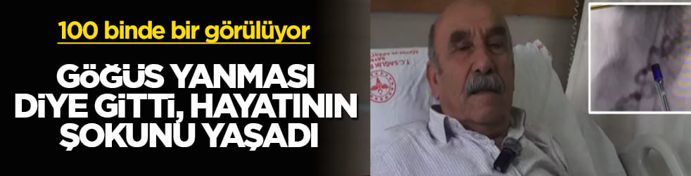 100 binde bir görülüyor! Göğüs yanması diye gitti, hayatının şokunu yaşadı