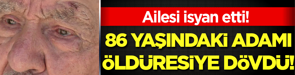 86 yaşındaki adamı öldüresiye dövdü! Ailesi isyan etti!
