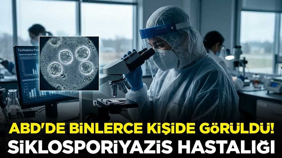 ABD'de binlerce kişide görüldü! Siklosporiyazis hastalığı