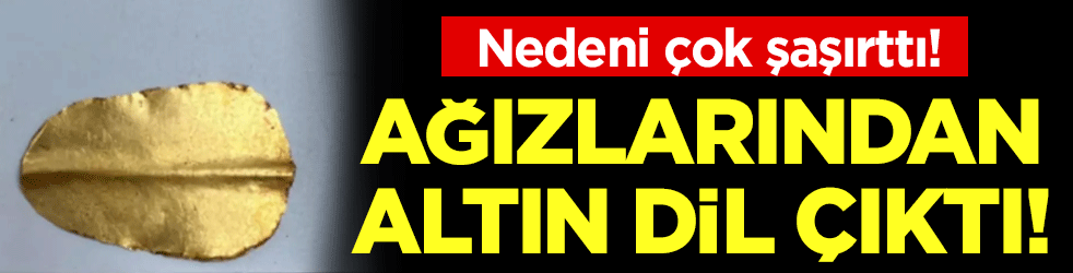 Ağızlarından altın dil çıktı! Nedeni çok şaşırttı!