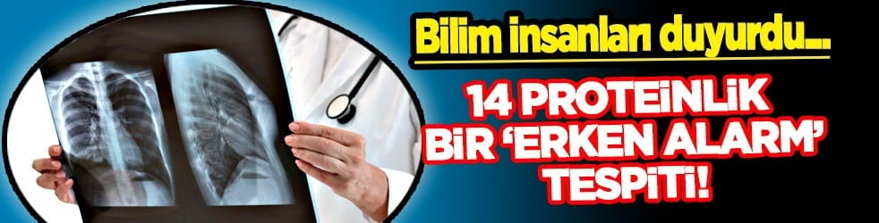 Akciğer kanserini herkes tespit edilemez zannediyor ama 14 proteinlik veri bulundu... Bakın kim, nasıl buldu