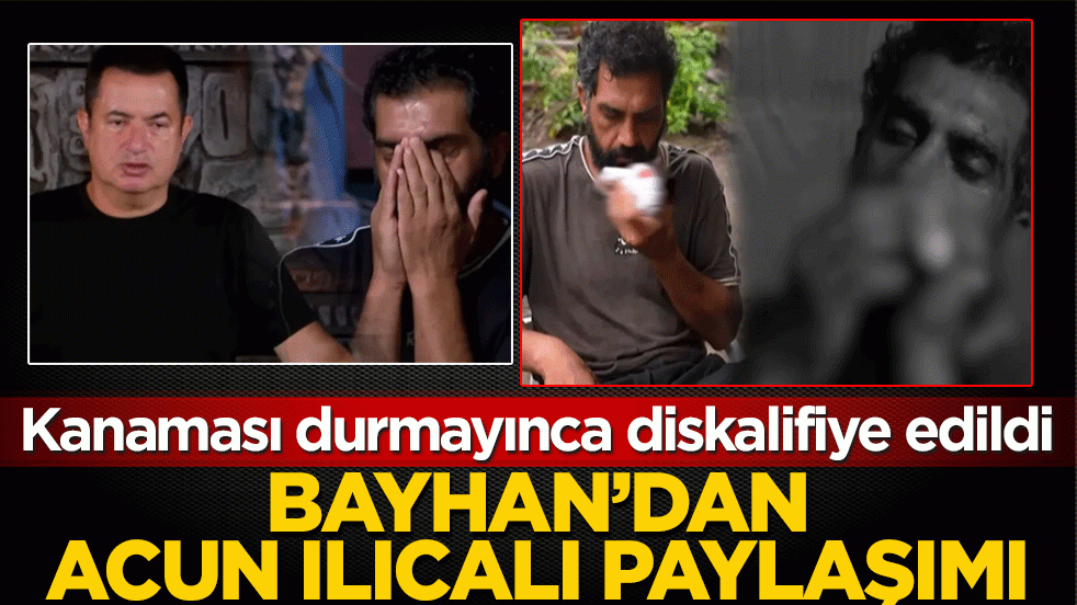 Bayhan’dan Acun Ilıcalı paylaşımı: Kanaması durmayınca diskalifiye edildi