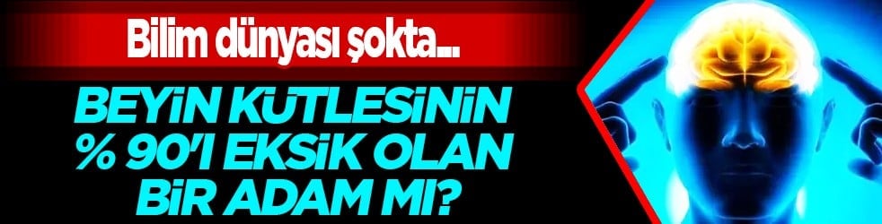 Beyin kütlesinin %90'ı eksik olan bir adam keşfedildi: Buna rağmen... Büyük şok etkisi!