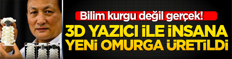 Bilim kurgu değil gerçek! 3D yazıcı ile insana yeni omurga üretildi!
