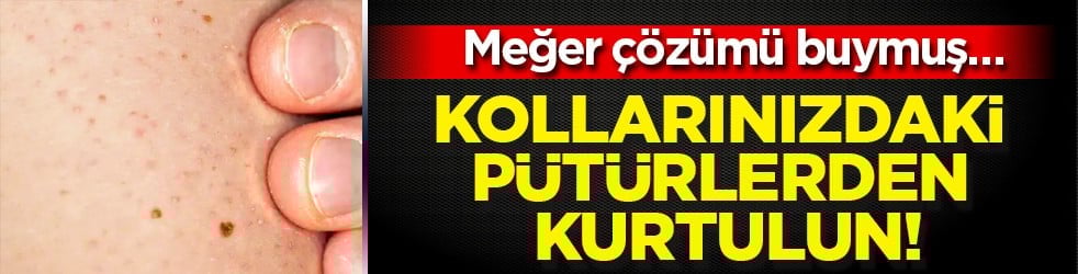 Cildinizdeki o pütürlerden kurtulun! Meğer 'tavuk derisi' görünümünün çözümü buymuş…