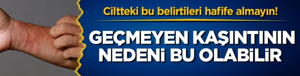 Ciltteki bu belirtileri hafife almayın! Geçmeyen kaşıntının nedeni bu olabilir