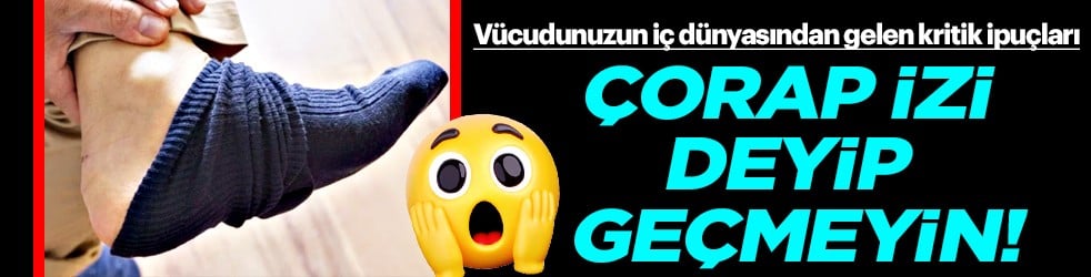 Çoğu zaman fark edemiyorsunuz ama... Çorap izi deyip geçmeyin
