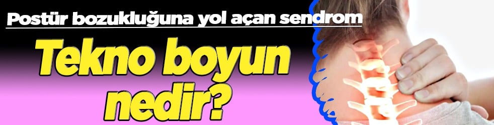 Dijital cihaz çoğaldıkça... Postür bozukluğuna yol açan sendrom: Tekno boyun nedir?
