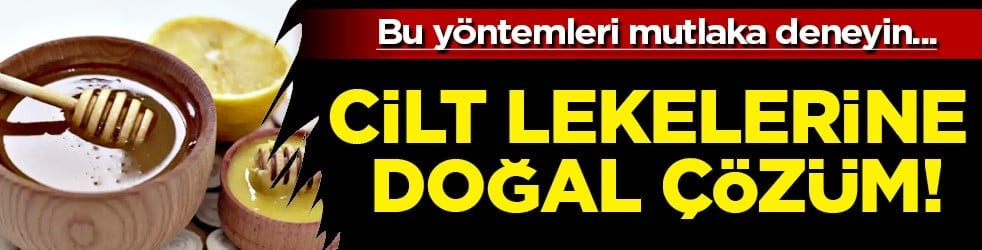 Doğal içeriklerle yapılan kürler... Cilt lekelerine sağlıklı çözüm: Limon ve bal