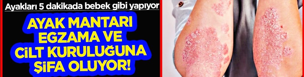 Egzamaya, ayak mantarına, cilt kuruluğuna şifa kaynağı! Ayakları 5 dakikada bebek gibi yapıyor