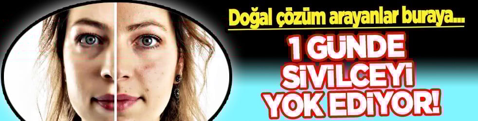 En can sıkıcı boyutu: 1 günde sivilceyi yok ediyor! Doğal çözüm arayanlar buraya...