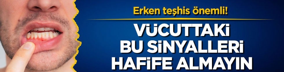 Erken teşhis önemli! Vücuttaki bu sinyalleri hafife almayın