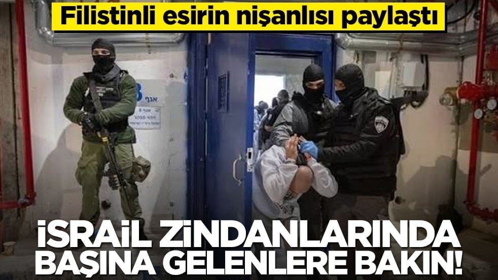 Filistinli esirin nişanlısı paylaştı: İsrail zindanlarında başına gelenlere bakın!