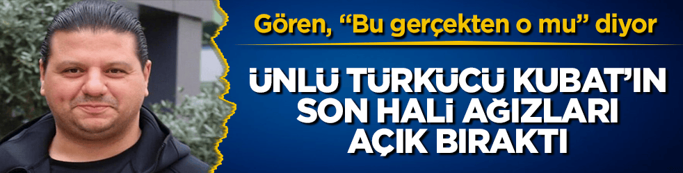 Gören, "Bu gerçekten o mu" diyor! Ünlü türkücü Kubat’ın son hali ağızları açık bıraktı 