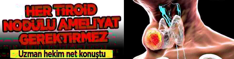 Her tiroid nodülü ameliyat gerektirmez diyerek açıkladı! Ablasyon işleminin...