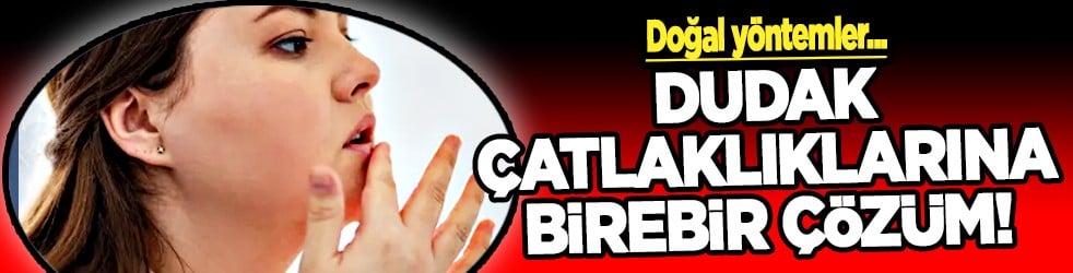 İşte doğal yöntemlerle bu havalarda korunmanın yolu: Dudak çatlaklıklarına birebir çözüm!