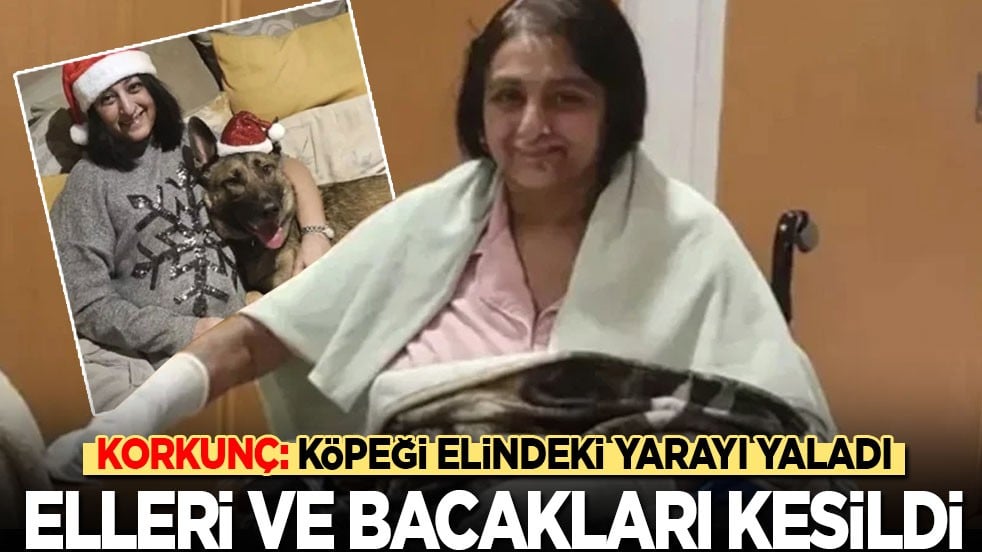 Korkunç: Köpeği yarasını yaladı, elleri ve bacakları kesildi