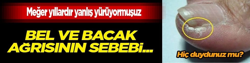 Meğer yıllardır yanlış yürüyormuşuz: Bel ve bacak ağrısının sebebi... Zarar vermek istemiyorsanız uzak durun