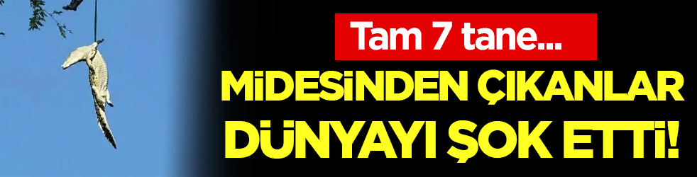 Midesinden çıkanlar dünyayı şok etti! Tam 7 tane...