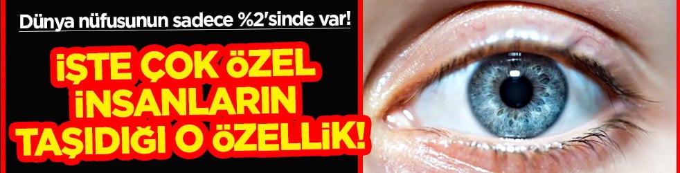 O azınlıktaysanız... Dünya nüfusunun sadece %2'sinde var! Çok özel insanların taşıdığı özellik...