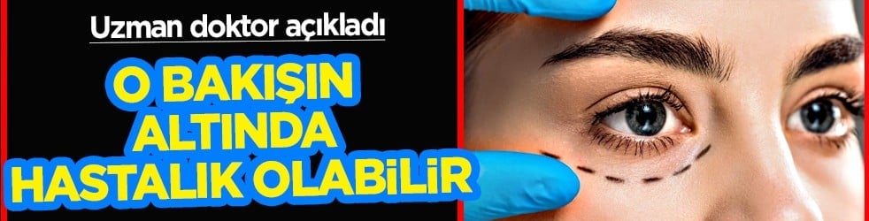 Op. Dr. açıkladı: Çekici görünen bakışın altında hastalık olabilir