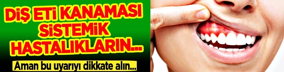 Periodontal hastalıklar, diyabet ve solunum... Diş eti kanaması sistemik hastalıkların habercisi olabilir