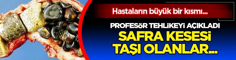 Prof. Dr. Çetinkünar en büyük tehlikeyi açıkladı: Safra kesesi taşı taşınınca ne olur?
