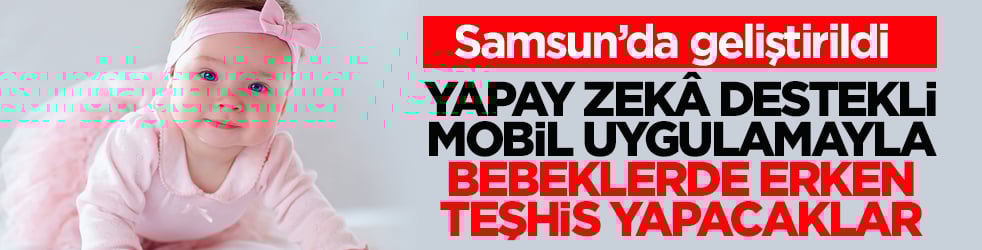 Samsun’da geliştirildi! Yapay zekâ destekli mobil uygulamayla bebeklerde erken teşhis yapacaklar