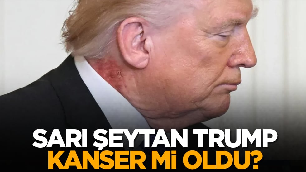 Sarı şeytan Trump kanser mi oldu?