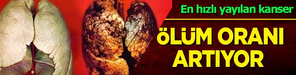 Sigara içenler, ölüm oranı birinci sırada! Uzmanlar ürküten açıklamayı yaptı! Akciğerleri adeta iflas ettiriyor