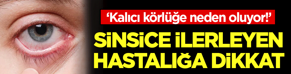 Sinsice ilerleyen hastalığa dikkat: Kalıcı körlüğe neden oluyor!