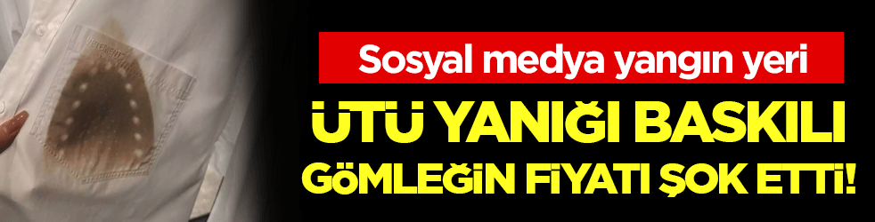 Sosyal medya yangın yeri: Ütü yanığı baskılı göleğin fiyatı şok etti!