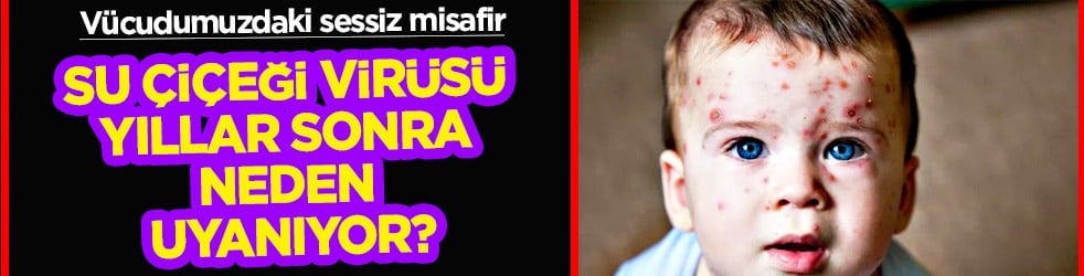 Su çiçeği virüsü yıllar sonra neden uyanıyor? Ortaya çıkan bir enfeksiyon ve...